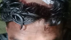 ঈদে জুয়া খেলায় বাধা দেওয়ায় বিএনপি কর্মীকে মারধরের অভিযোগ, মামলার প্রস্তুতি