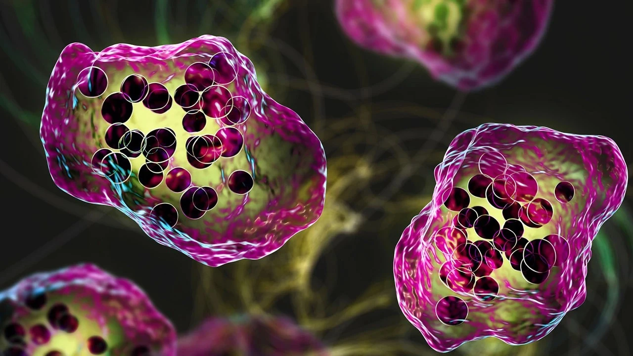 হামে আরও ৭ মৃত্যু, হাসপাতালে ভর্তি ১১৮৭ রোগী