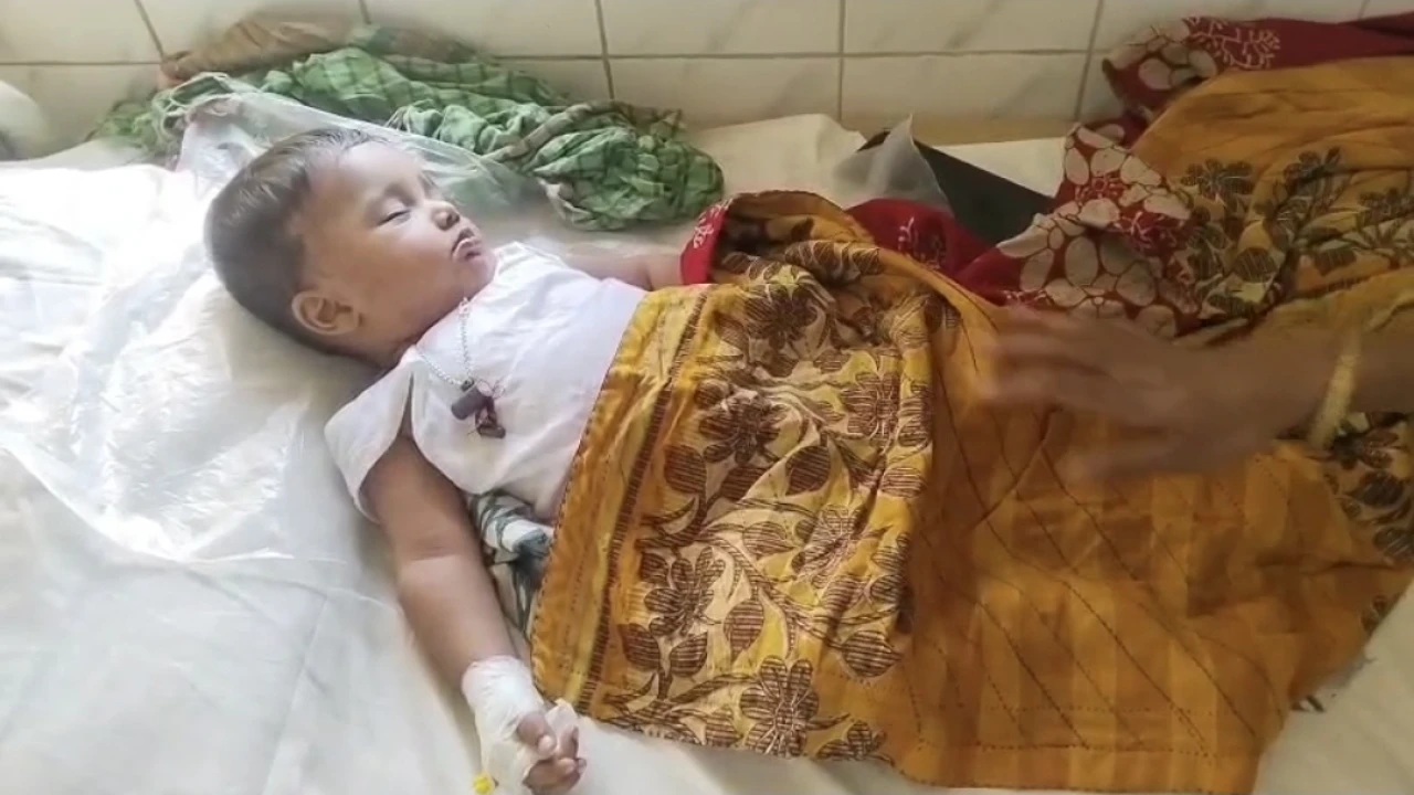 ঝালকাঠিতে হাম-রুবেলায় আক্রন্ত হয়ে ১৯ জন হাসপাতালে ভর্তি