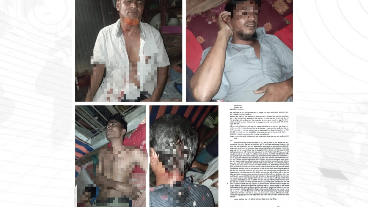 চল কলাতলীতে  সন্ত্রাসী হামলায় বিএনপির সভাপতি সহ আহত একাধিক,হাসপাতালে ভর্তি