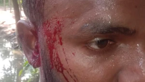 ঈশ্বরগঞ্জে জমি সংক্রান্ত বিরোধে হামলা, বৃদ্ধসহ একই পরিবারের আহত ৪