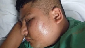 মোটরসাইকেল চুরির মামলার সাক্ষীকে মারধর