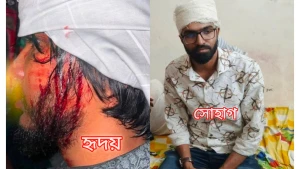 নোয়াখালীতে ছাত্রদলের মিছিলে হামলার অভিযোগ: রক্তাক্ত নোয়াখালী কলেজ ছাত্রদল সভাপতি রাশেদুল ইসলাম সোহাগ ও শহর শ্রমিক দলের যুগ্ম সাধারণ সম্পাদক মো. হৃদয়